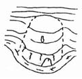 Figure 4.12 Convex Plateau